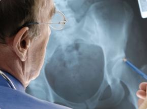 Восемь мифов об остеопорозе